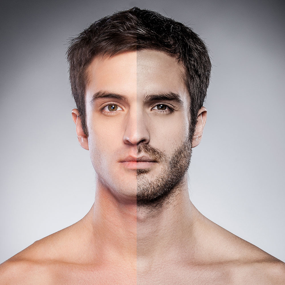 Beneficios del injerto de barba y bigote