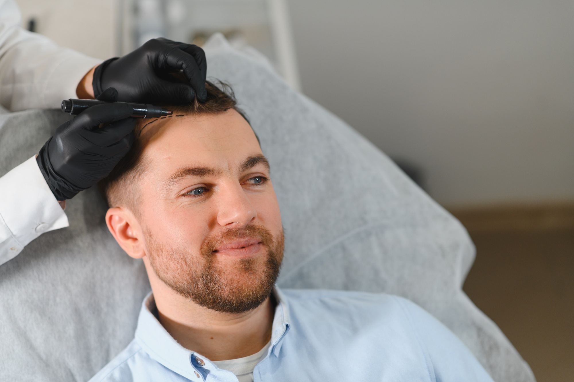 soluciones para la alopecia