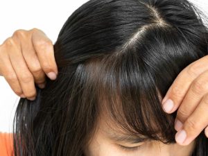 pelo largo tras injerto capilar