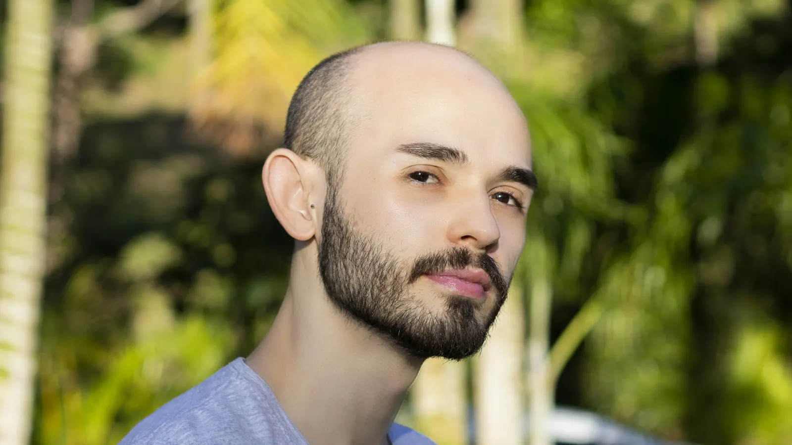 Hombre con cabeza rasurada y efecto de micropigmentación capilar
